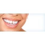 Dentsply E Ultra Non Latex Elastics Orthodontic Tooth Gap Bands - 3/8" QTY-100